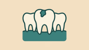 En tand med stort hul i