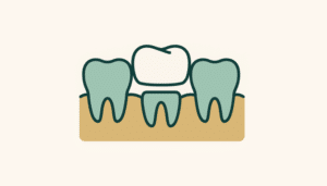 Tænder klar til tandbro