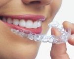 Skæve tænder - Tandretning Invisalign eller usynlige skinner
